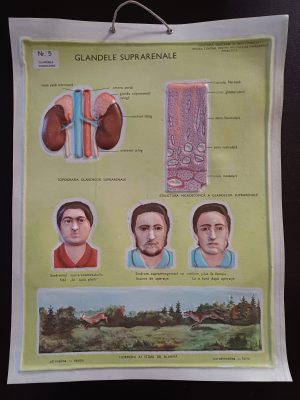 Glandele suprarenale, planșă didactică românească din plastic cu figuri în relief, perioada comunistă